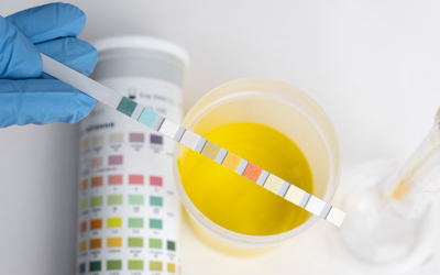 Иммунохроматографический тест на наркотики - Квинмед